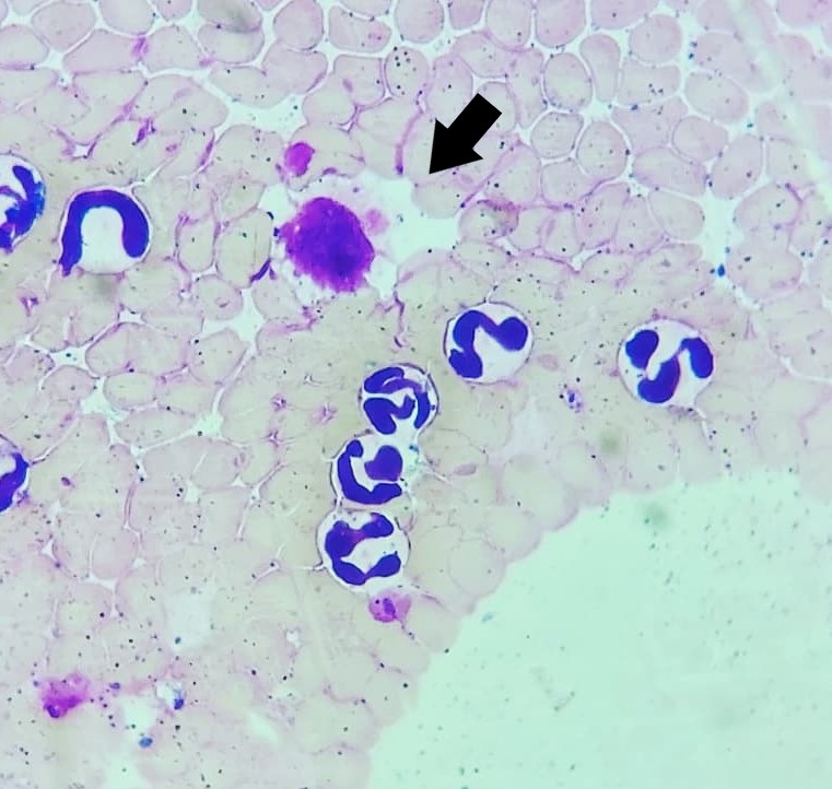 https://www.seleccionesveterinarias.com/files/Fig.1 Tinción Giemsa – Aumento (1000x). Presencia de mórula de Ehrlichia canis en un monocito.