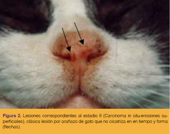 Proverbio sentar Escupir Carcinoma De Células Escamosas En El Plano Nasal Felino - Selecciones Veterinarias Proverbio sentar Escupir Carcinoma De Células Escamosas En El Plano Nasal Felino - Selecciones Veterinarias
